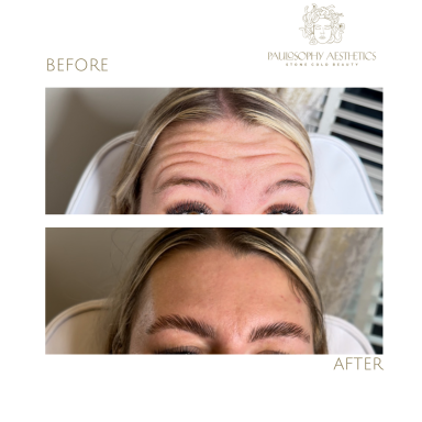 Anti-Wrinkle