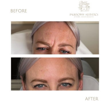 Anti-Wrinkle