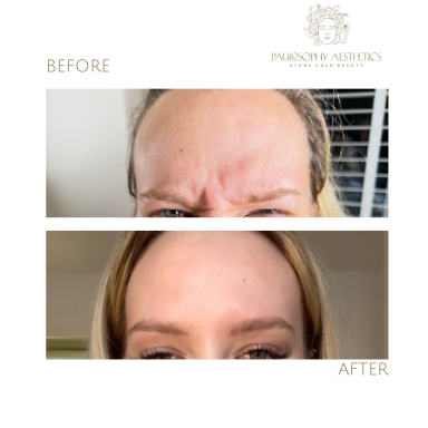 Anti-Wrinkle