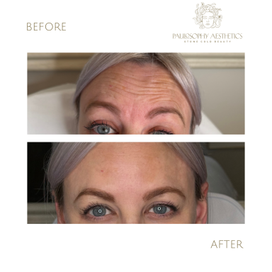 Anti-Wrinkle